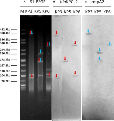 Prevalence of Carbapenem-Resistant Klebsiella pneumoniae Co-Harboring blaKPC-Carrying Plasmid and pLVPK-Like Virulence Plasmid in Bloodstream Infections